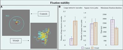 Eyetracking Metrics in Young Onset Alzheimer’s Disease: A Window into Cognitive Visual Functions